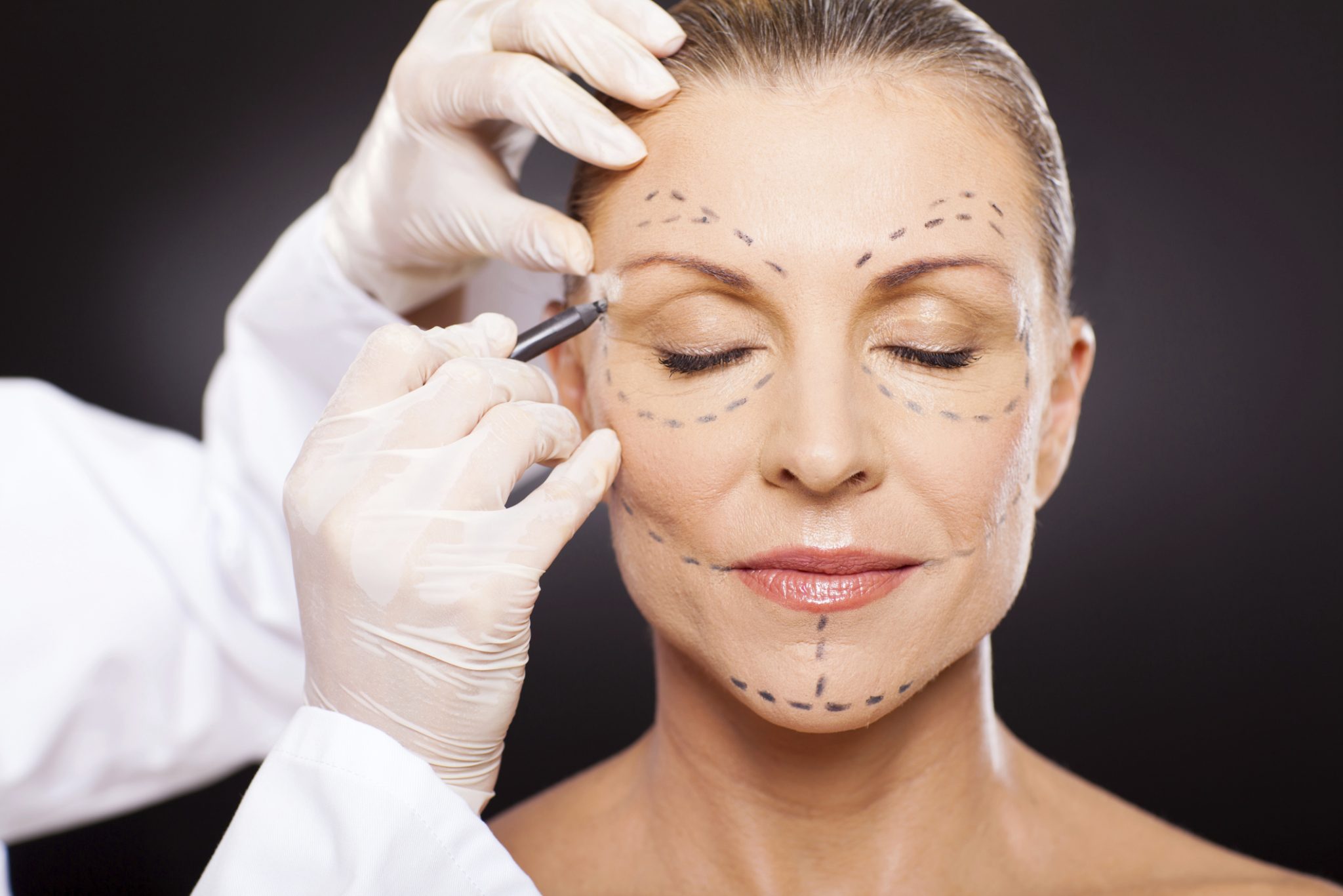 How Often Do I Need A Botox Touch-Up?