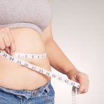 Bariatric Weight Loss Surgeries