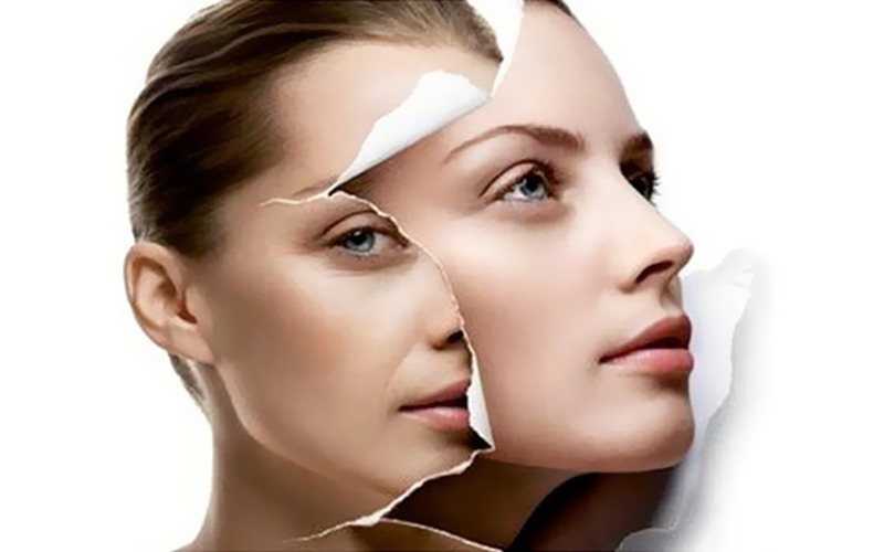 Skin Rejuvenation