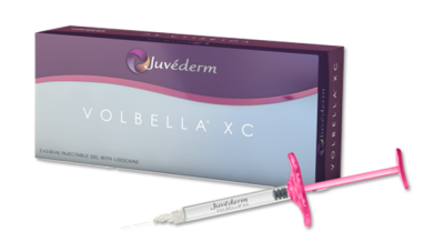 Volbella juvederm for treating Crows feet