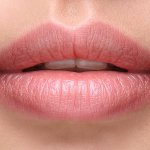 After Lip Filler - Sexy plump lips after filler injection