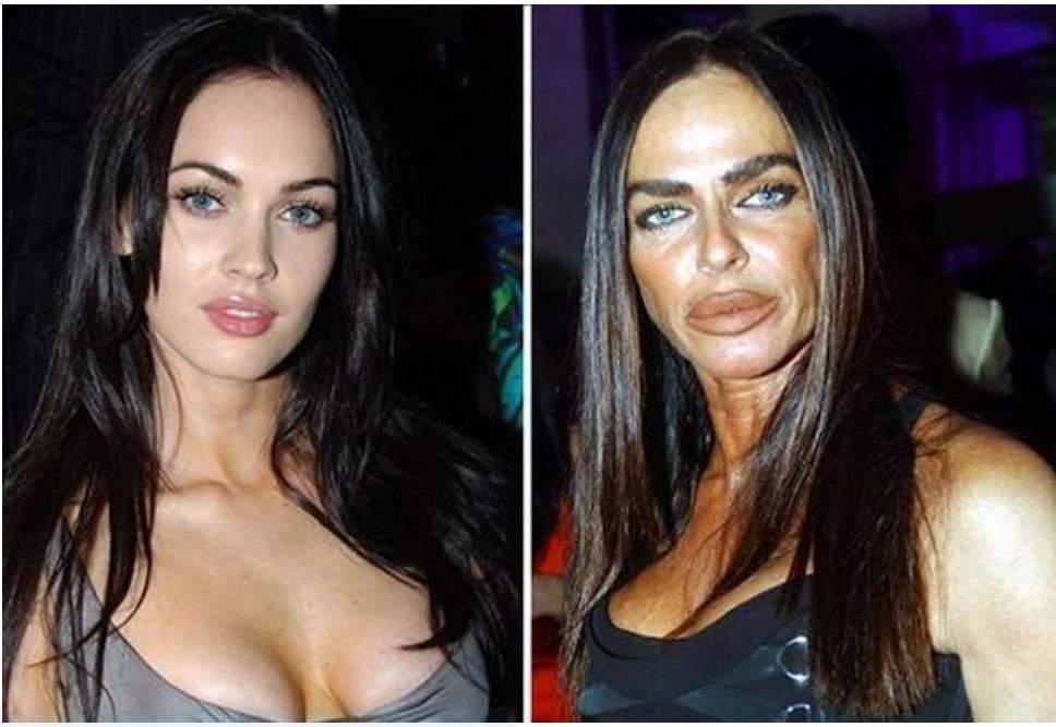 plastic surgery fail