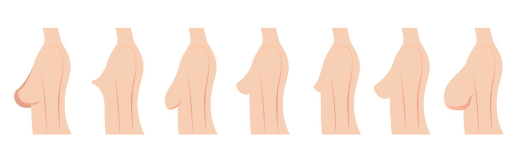 Sagging Breast Vector Images (49)