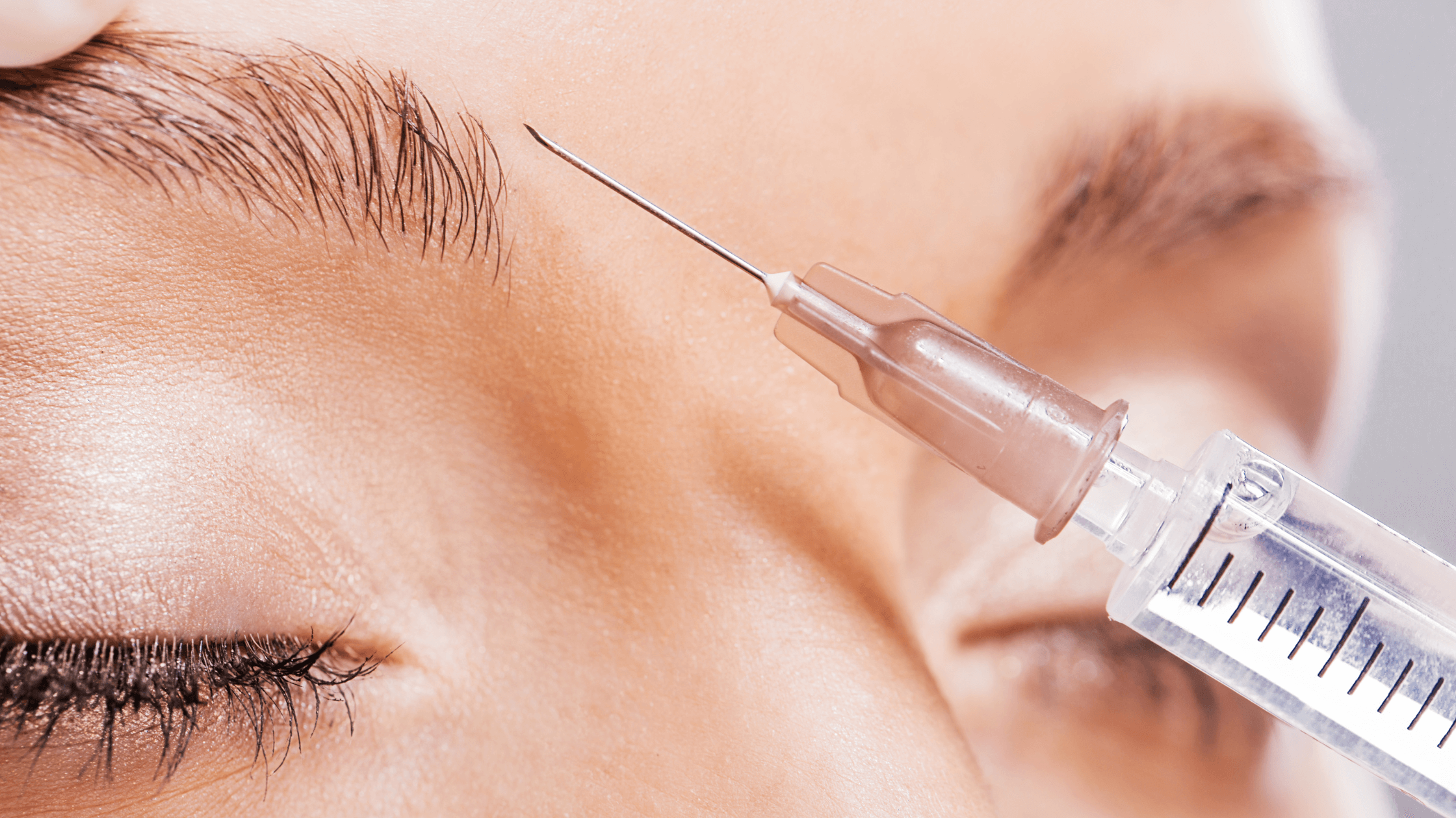 Elevate Your Look: Exploring the Benefits of BOTOX Brow Lifts!