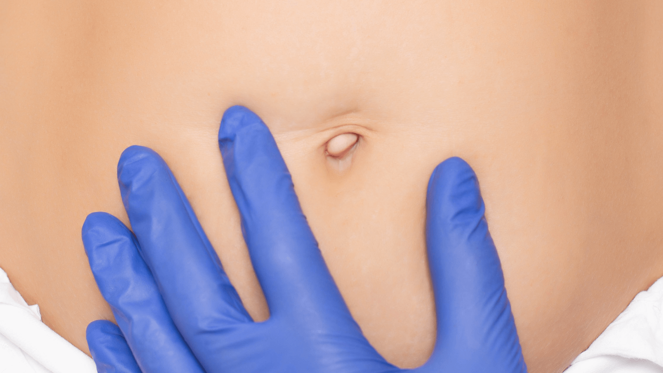 What Can Umbilicoplasty Do for Your