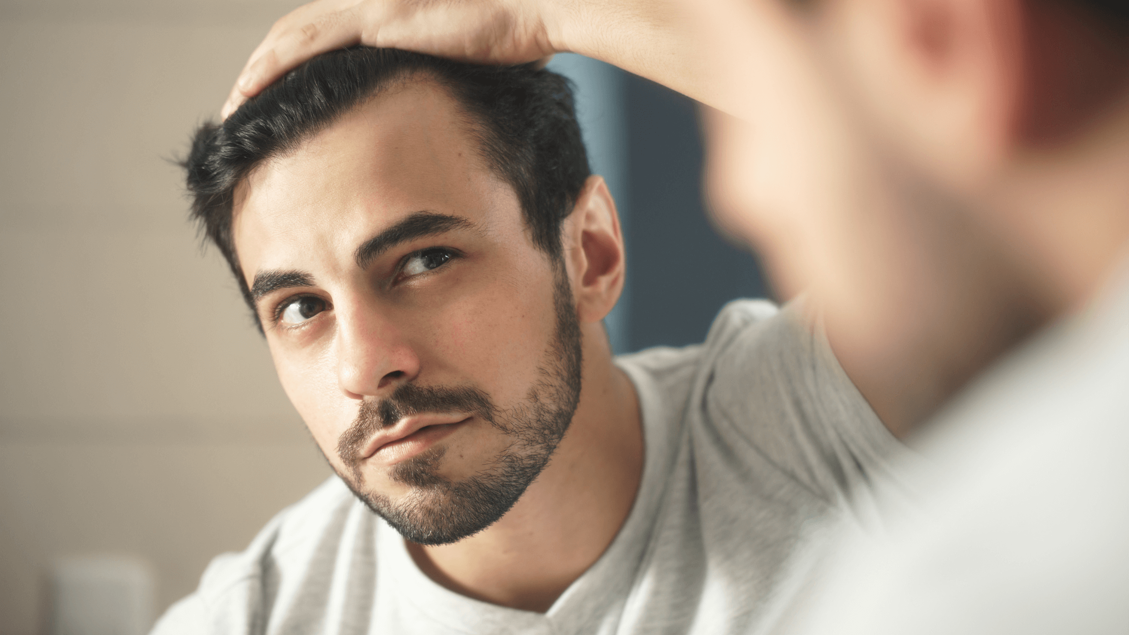 Microneedling for Hair Loss in Men