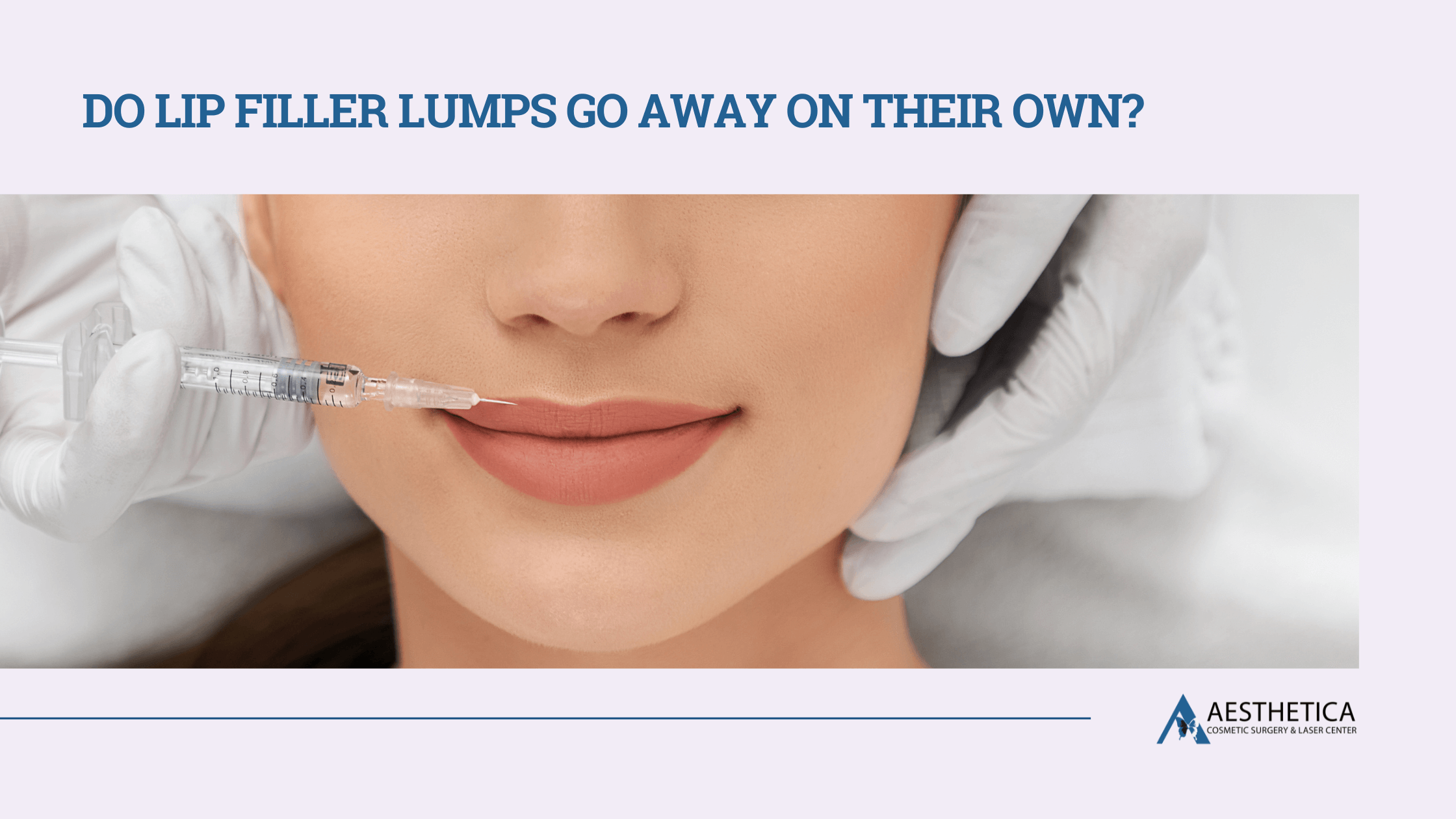 Do Lip Filler Lumps Go Away on Their Own?