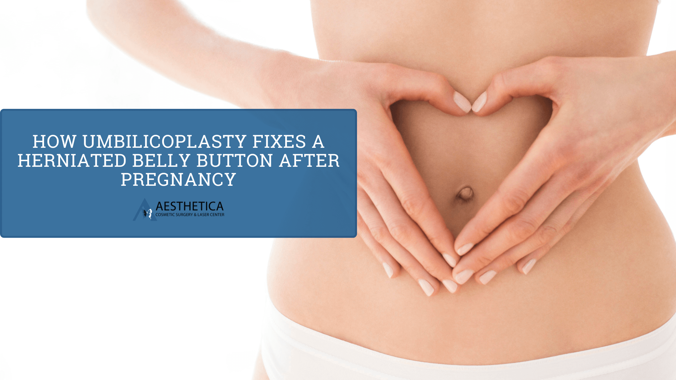 How Umbilicoplasty Fixes a Herniated Belly Button after Pregnancy