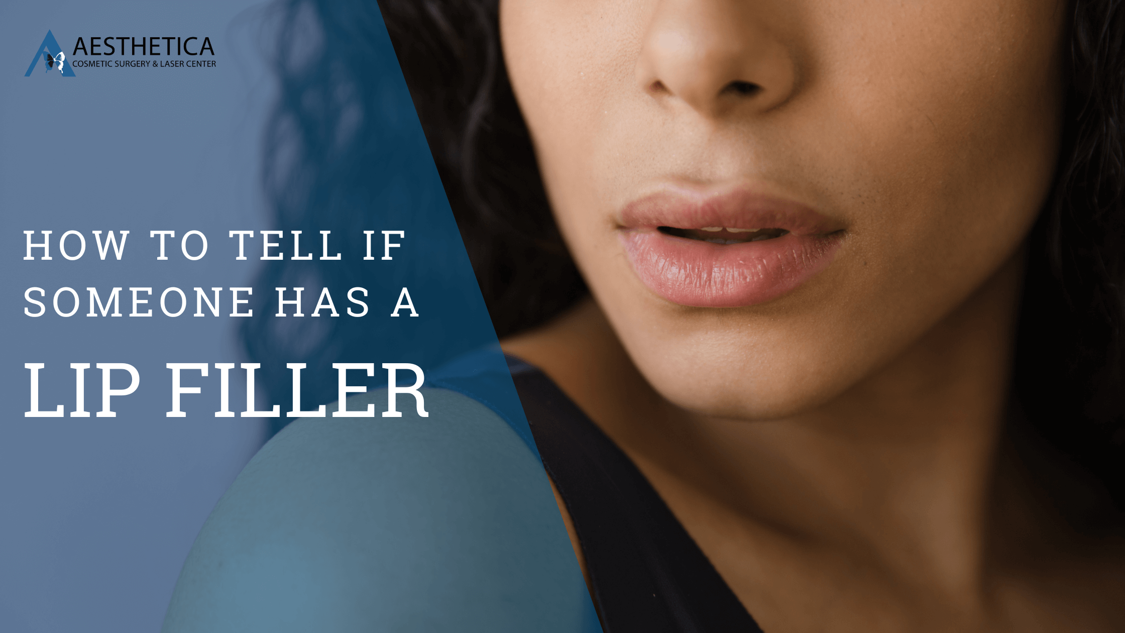 How to Tell if Someone Has Lip Filler