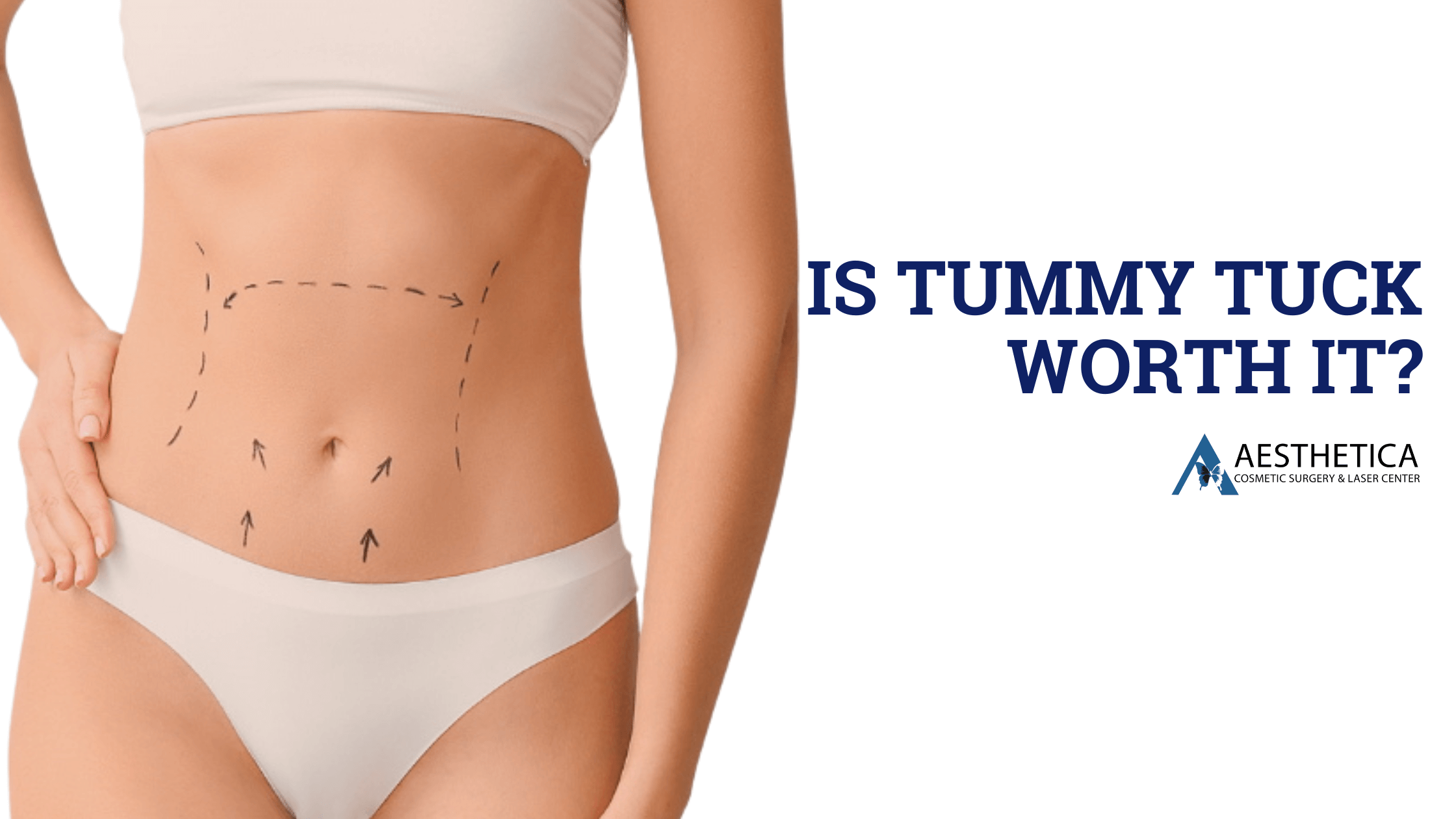 Is Tummy Tuck Worth It?