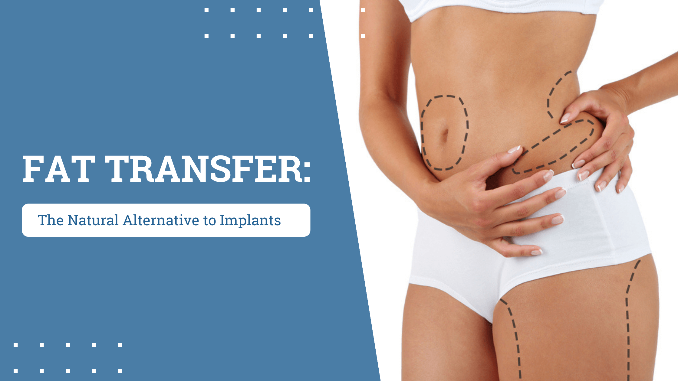 Fat Transfer: The Natural Alternative to Implants