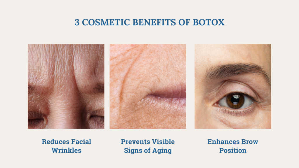 A graphic with three close-up images side by side, each depicting a different cosmetic benefit of BOTOX. The first shows a close-up of deeply furrowed brow wrinkles with the caption 'Reduces Facial Wrinkles'. The second image shows wrinkled skin around the mouth with the caption 'Prevents Visible Signs of Aging'. The third image displays an eye area with a lifted eyebrow with the caption 'Enhances Brow Position'. The header reads '3 COSMETIC BENEFITS OF BOTOX' in bold.