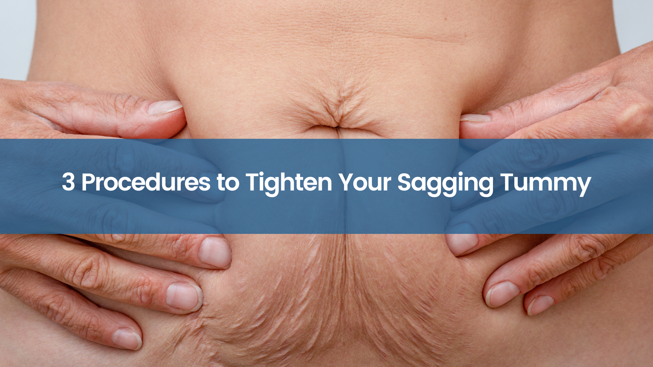 3 Procedures to Tighten Your Sagging Tummy