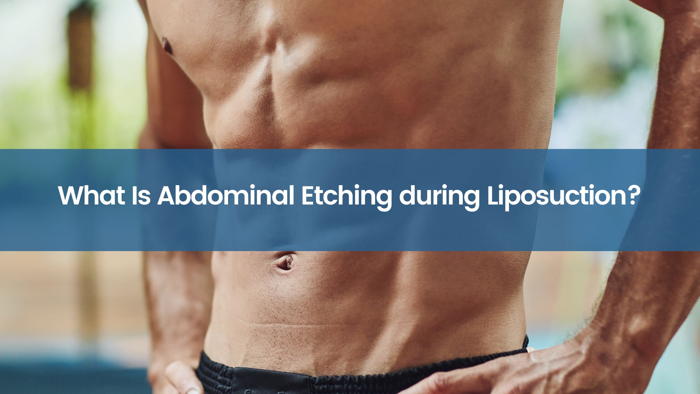 What Is Abdominal Etching during Liposuction?