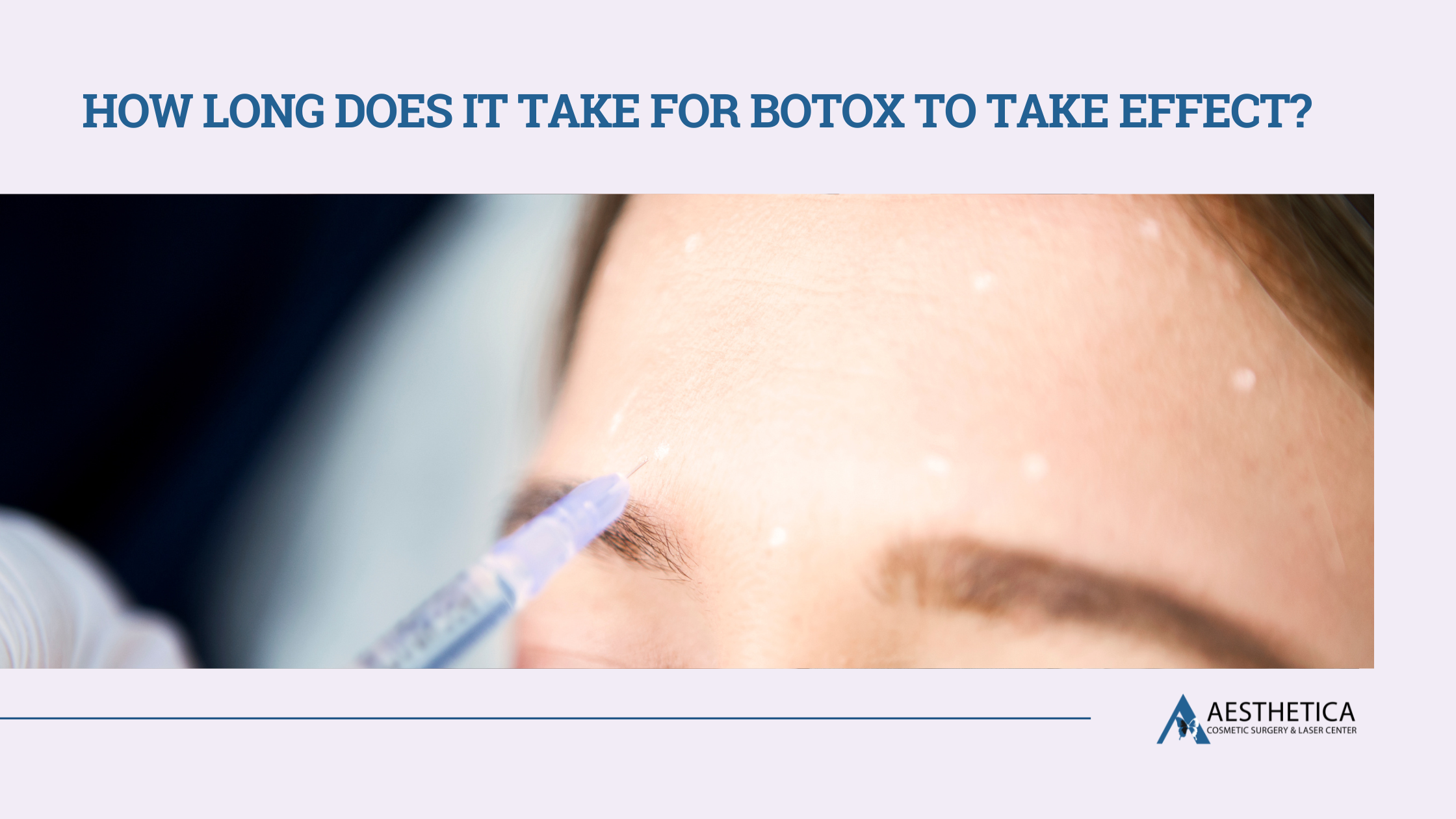 How Long Does It Take for BOTOX to Take Effect?