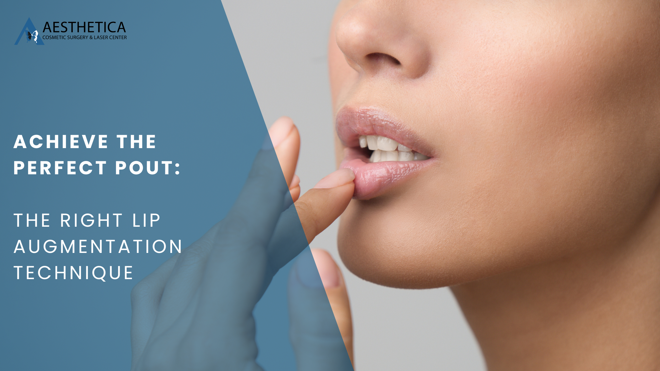 Achieve the Perfect Pout: How to Pick the Right Lip Augmentation Technique