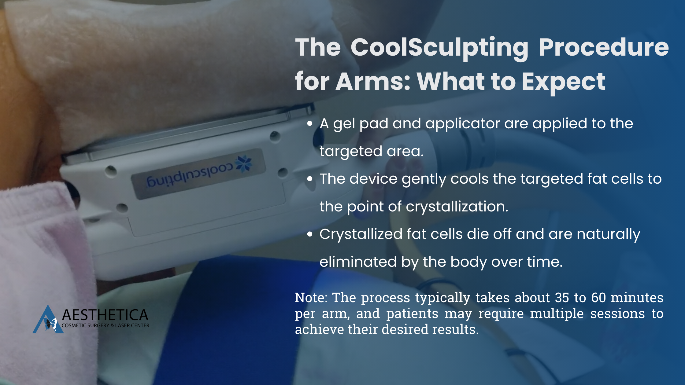 CoolSculpting for arms