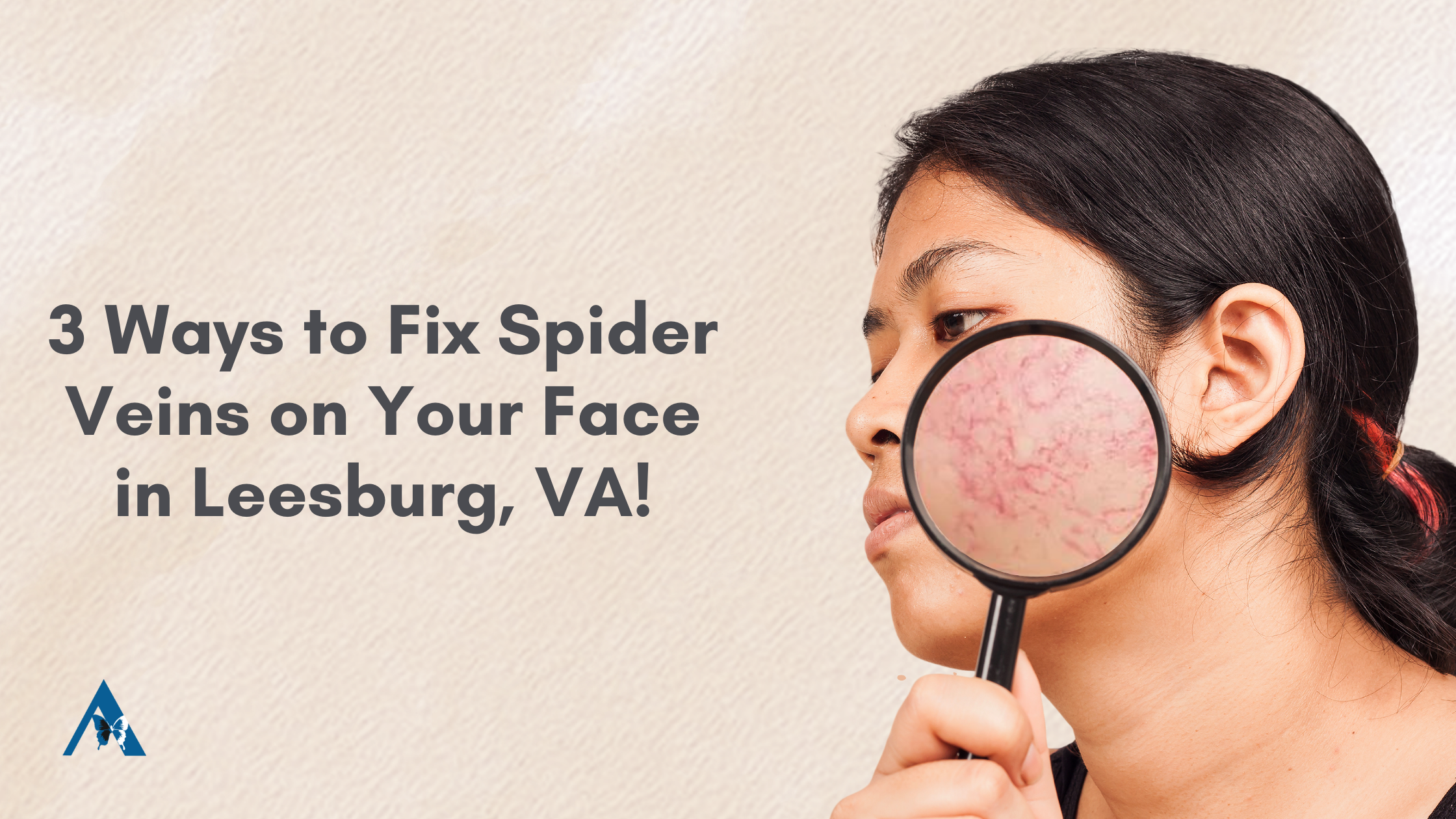 3 Ways to Fix Spider Veins on Your Face in Leesburg, VA!