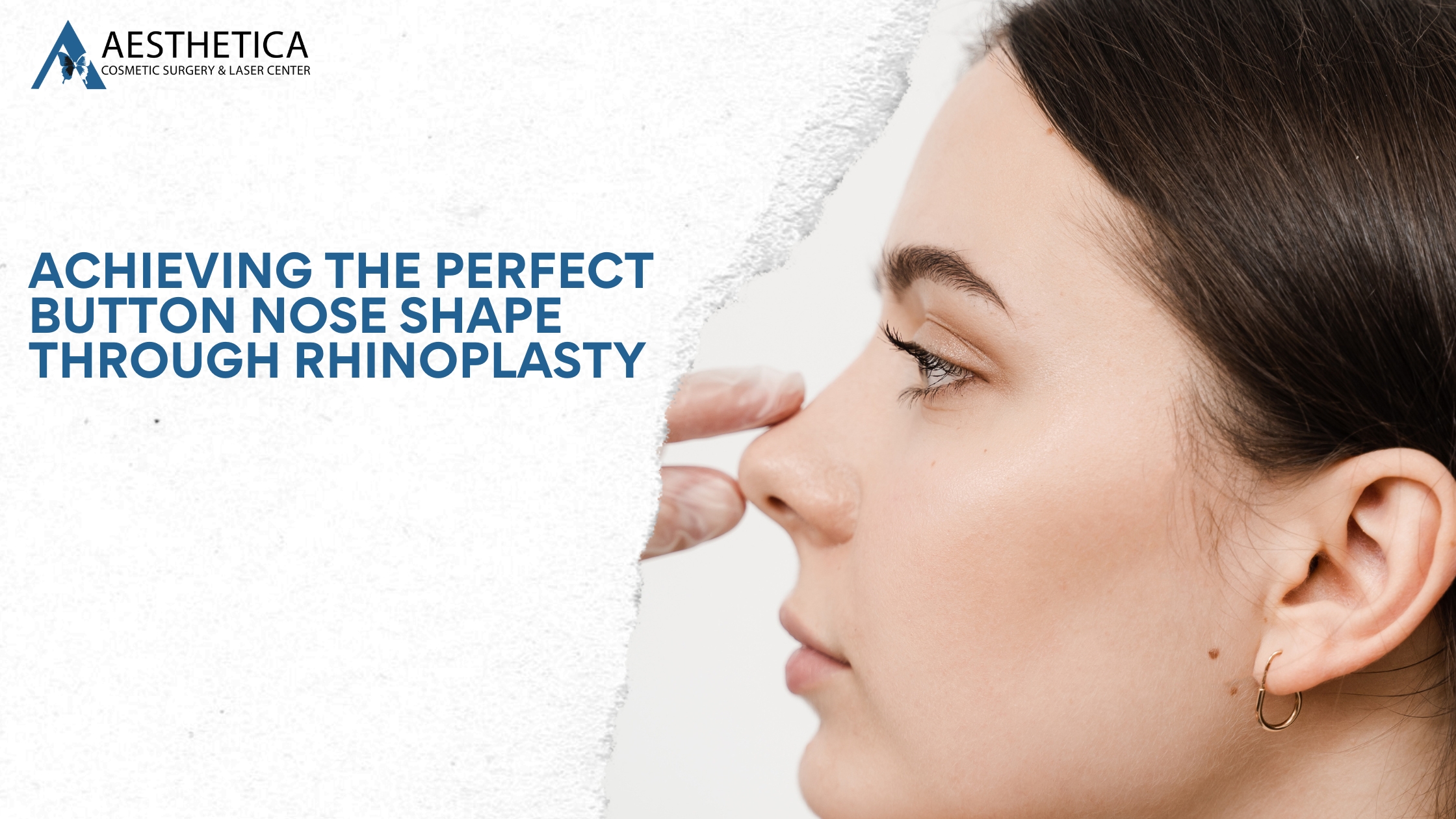 Achieving the Perfect Button Nose Shape Through Rhinoplasty