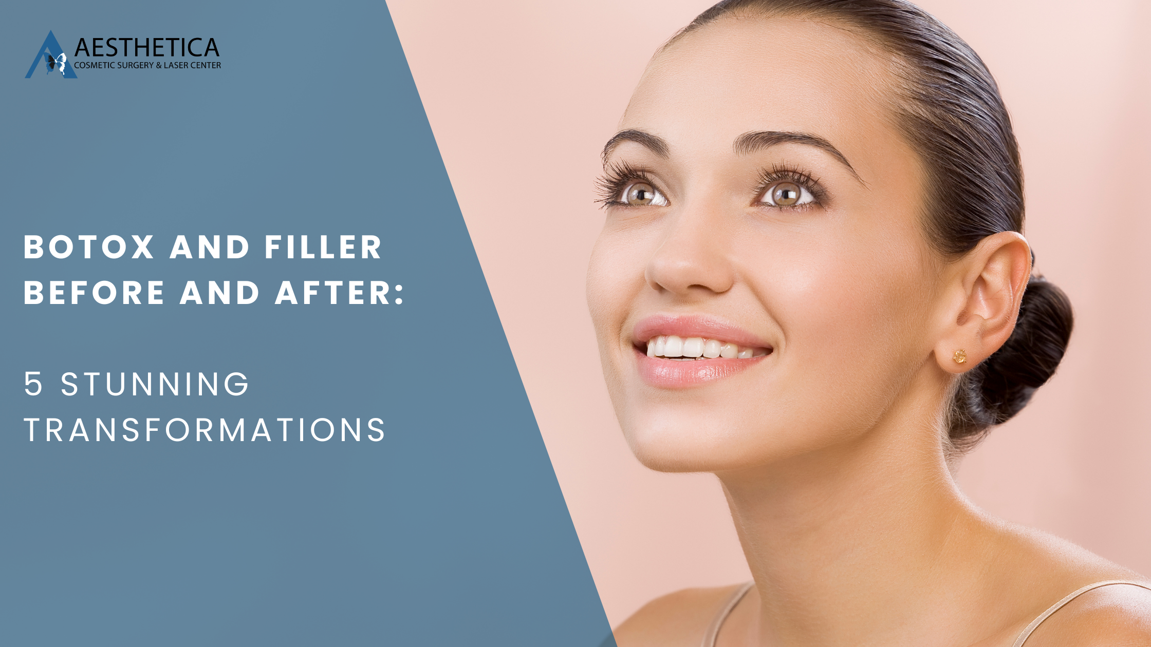 BOTOX and Filler Before and After: 5 Stunning Transformations