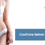 CoolTone Before and After