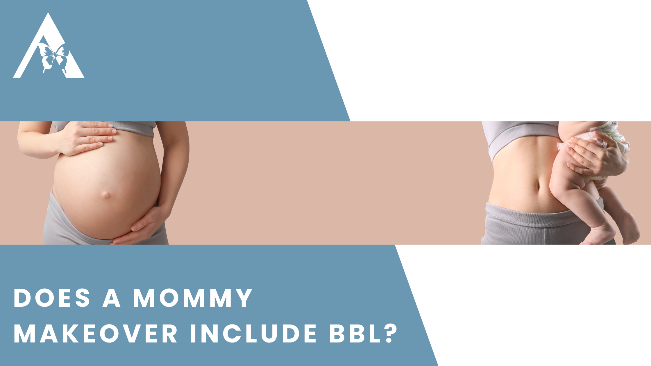 Does a Mommy Makeover Include BBL?