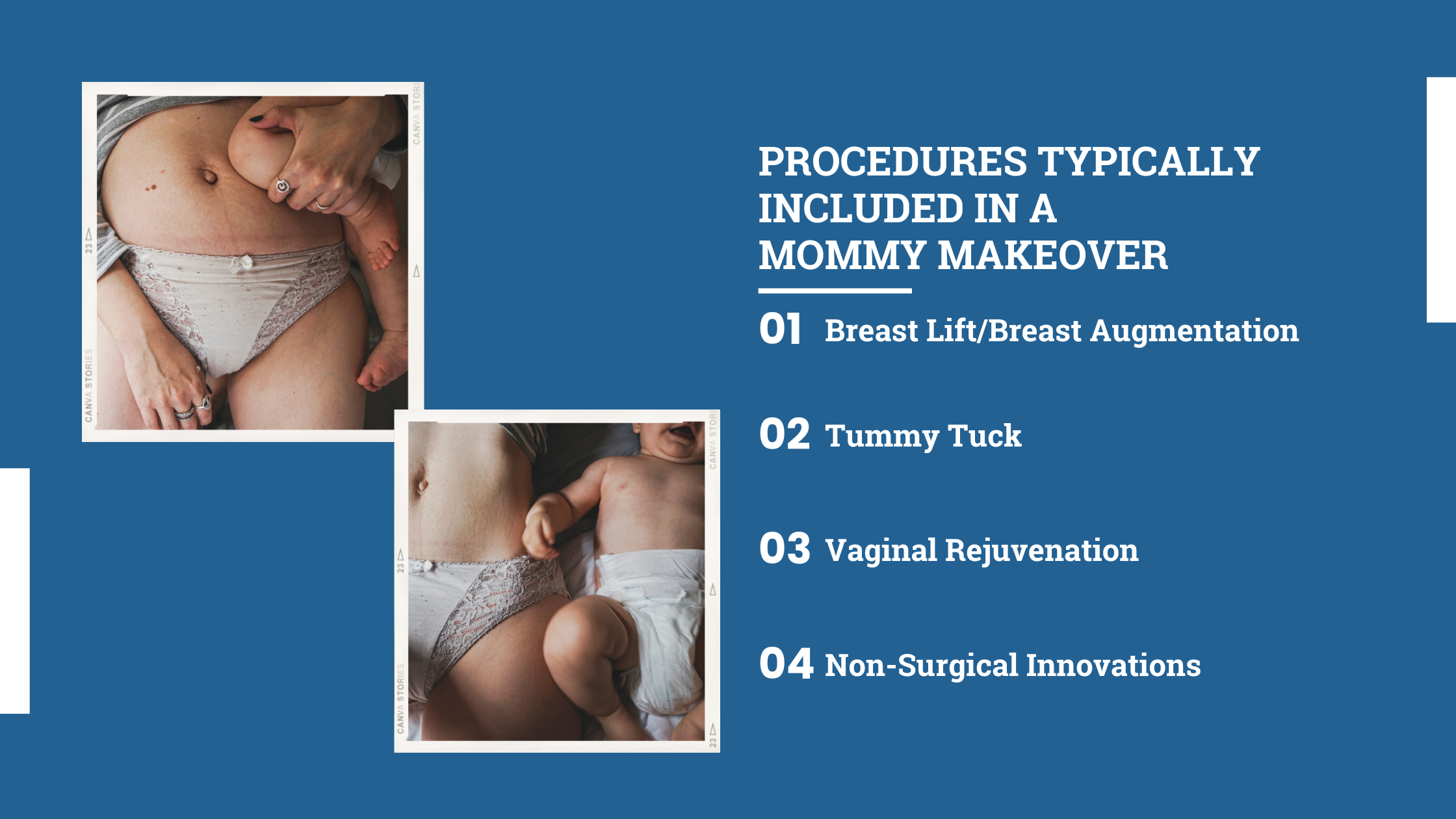 Procedures typically included in a mommy makeover