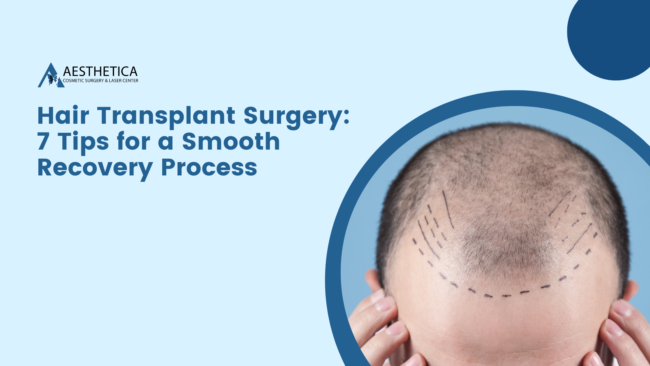 Hair Transplant Surgery: 7 Tips for a Smooth Recovery Process