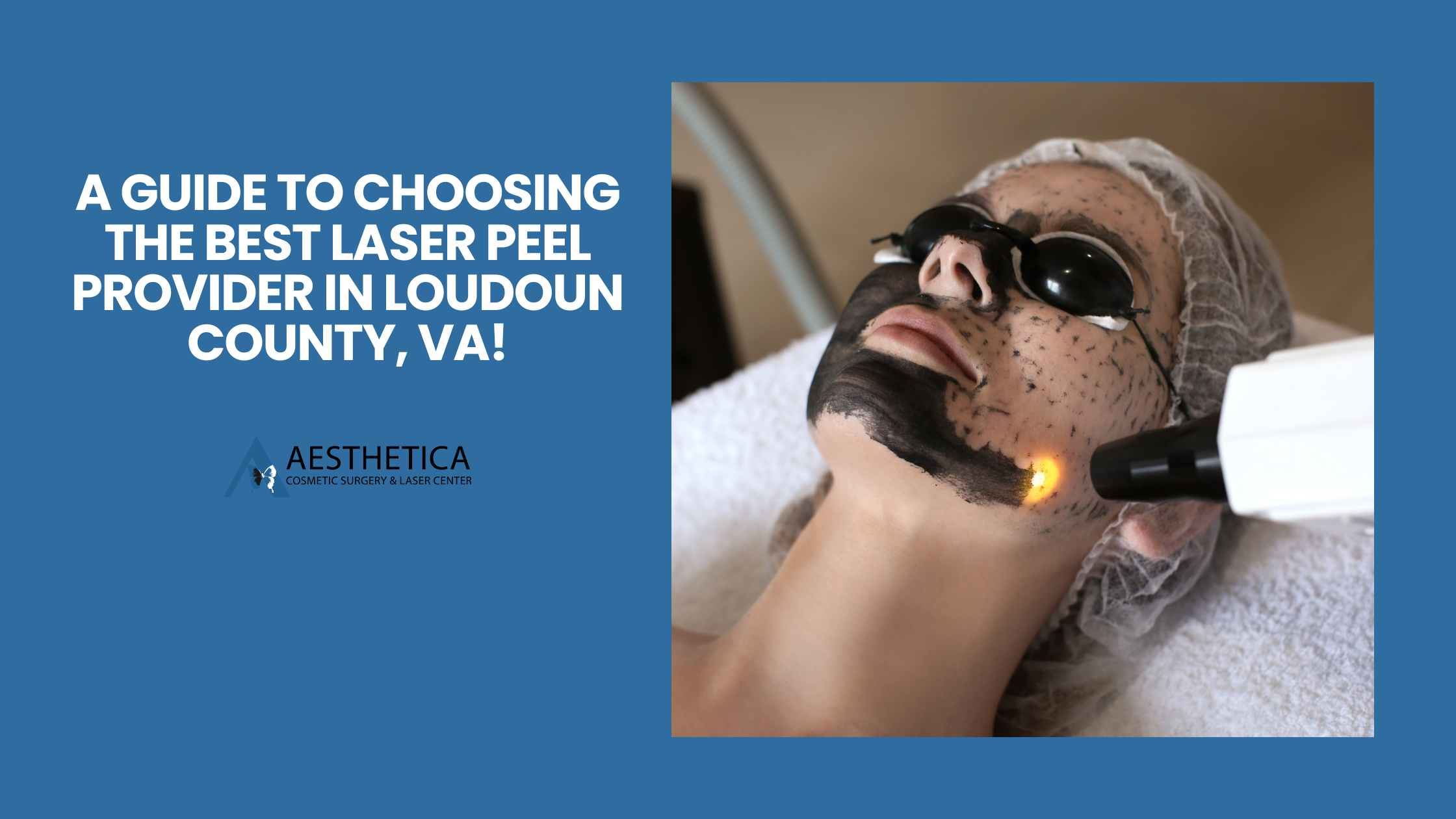 A Guide to Choosing the Best Laser Peel Provider in Loudoun County, VA!