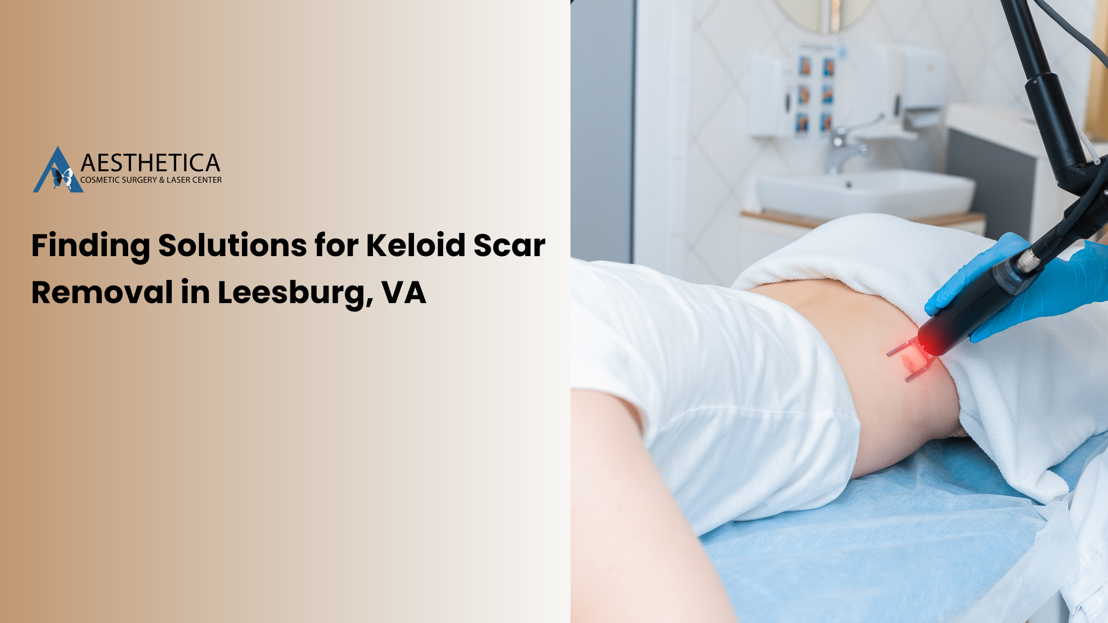 Finding Solutions for Keloid Scar Removal in Leesburg, VA