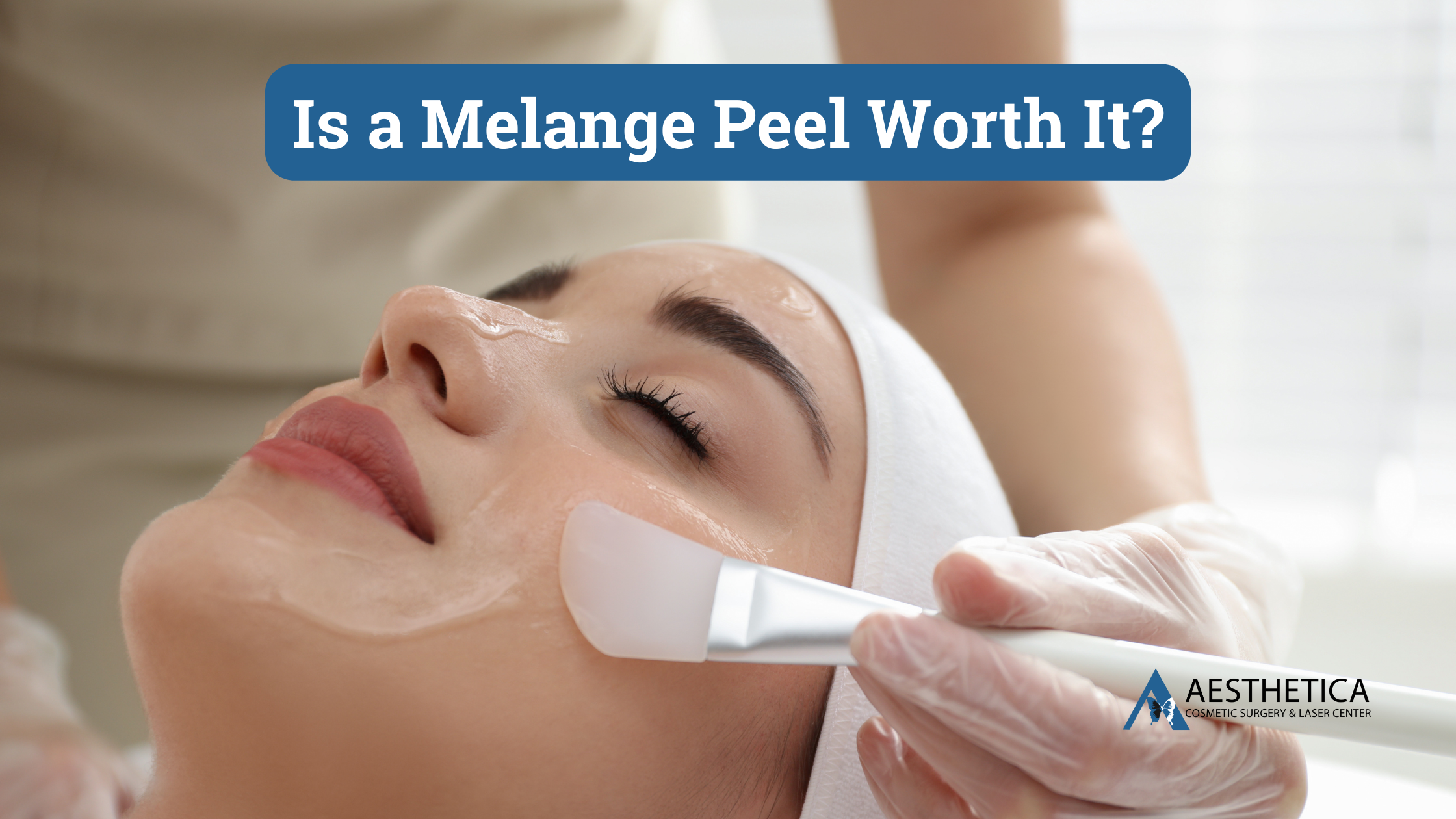 Is a Melange Peel Worth It?