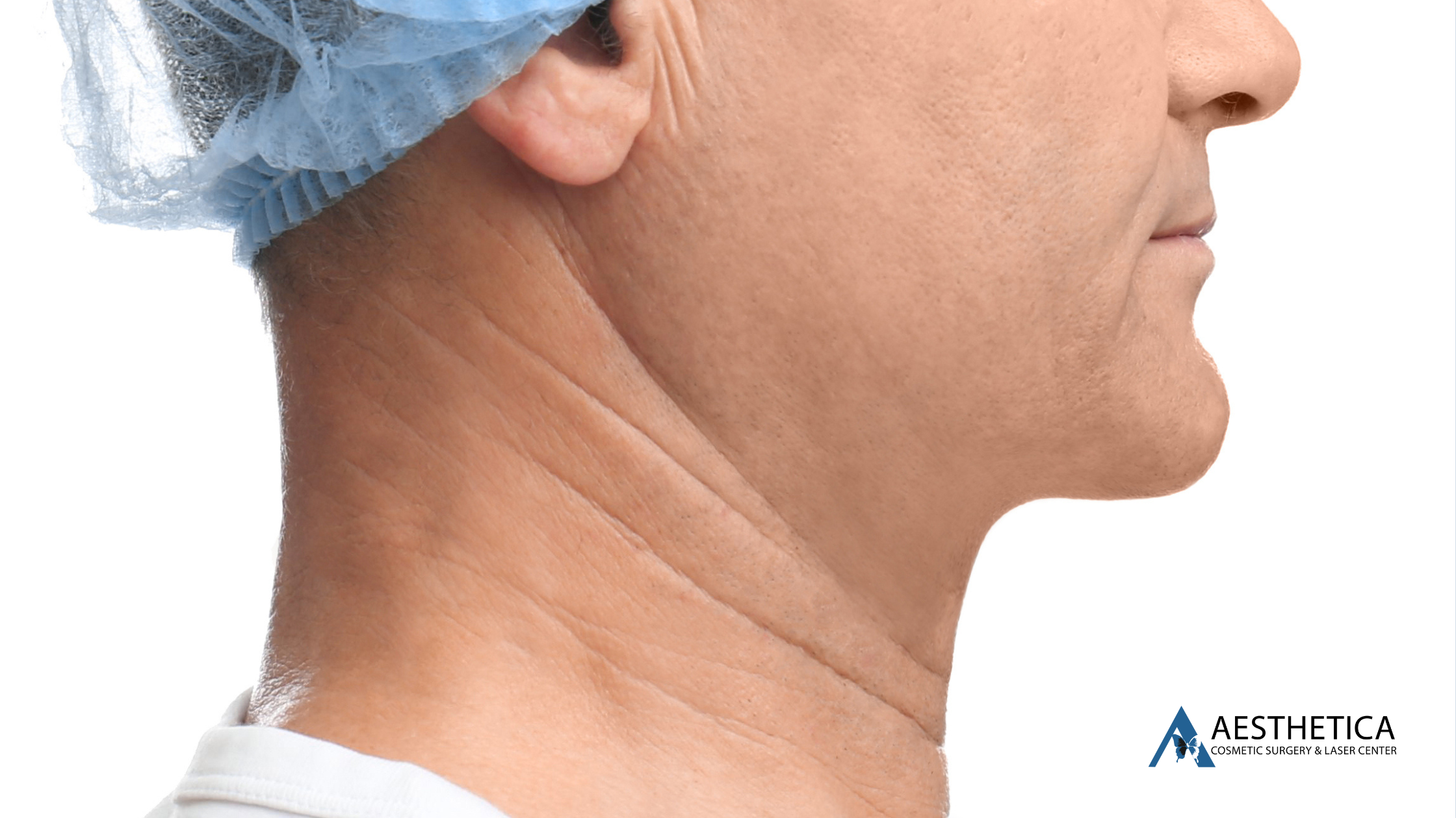 Male chin implant