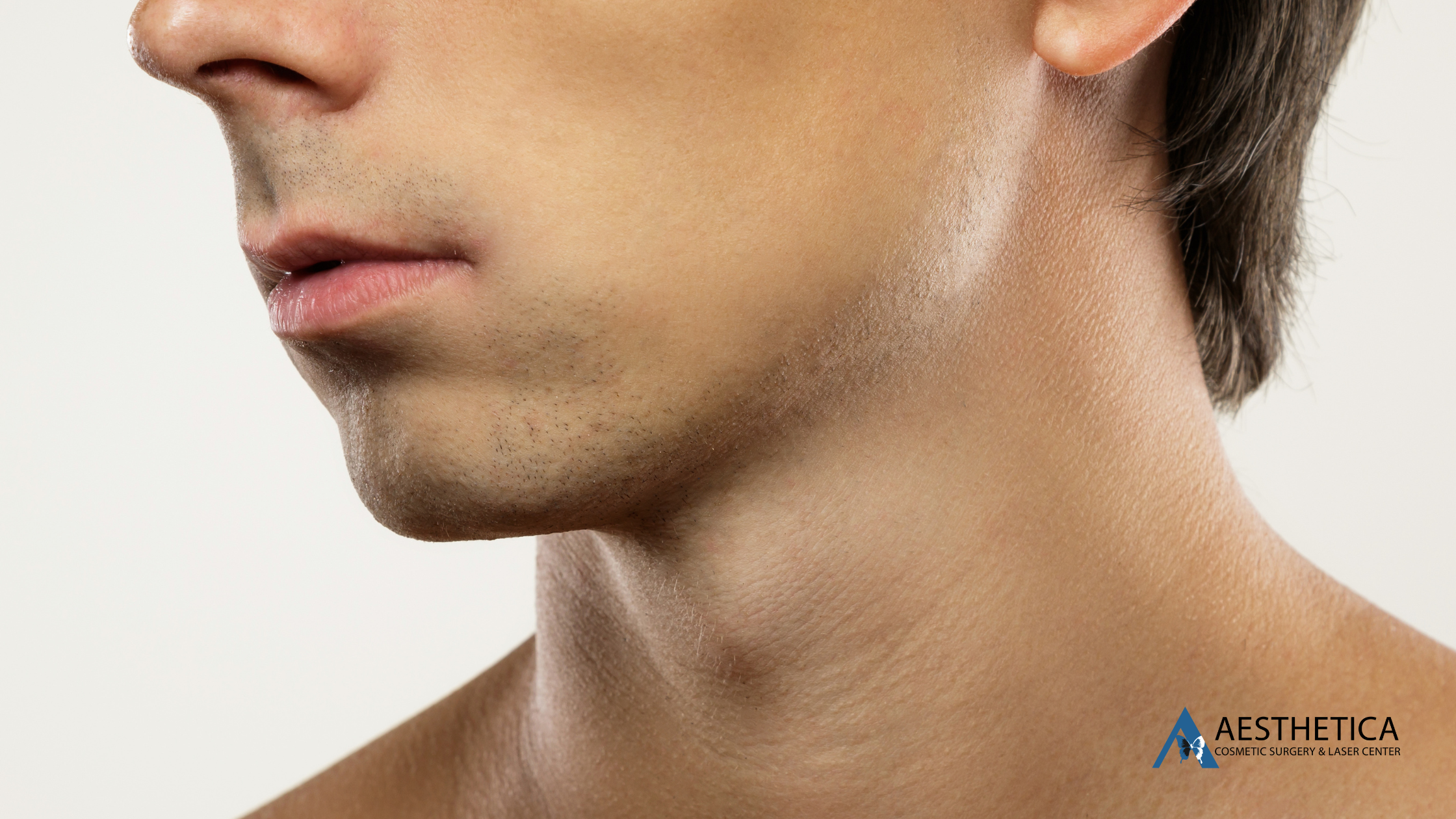Male Chin Implant
