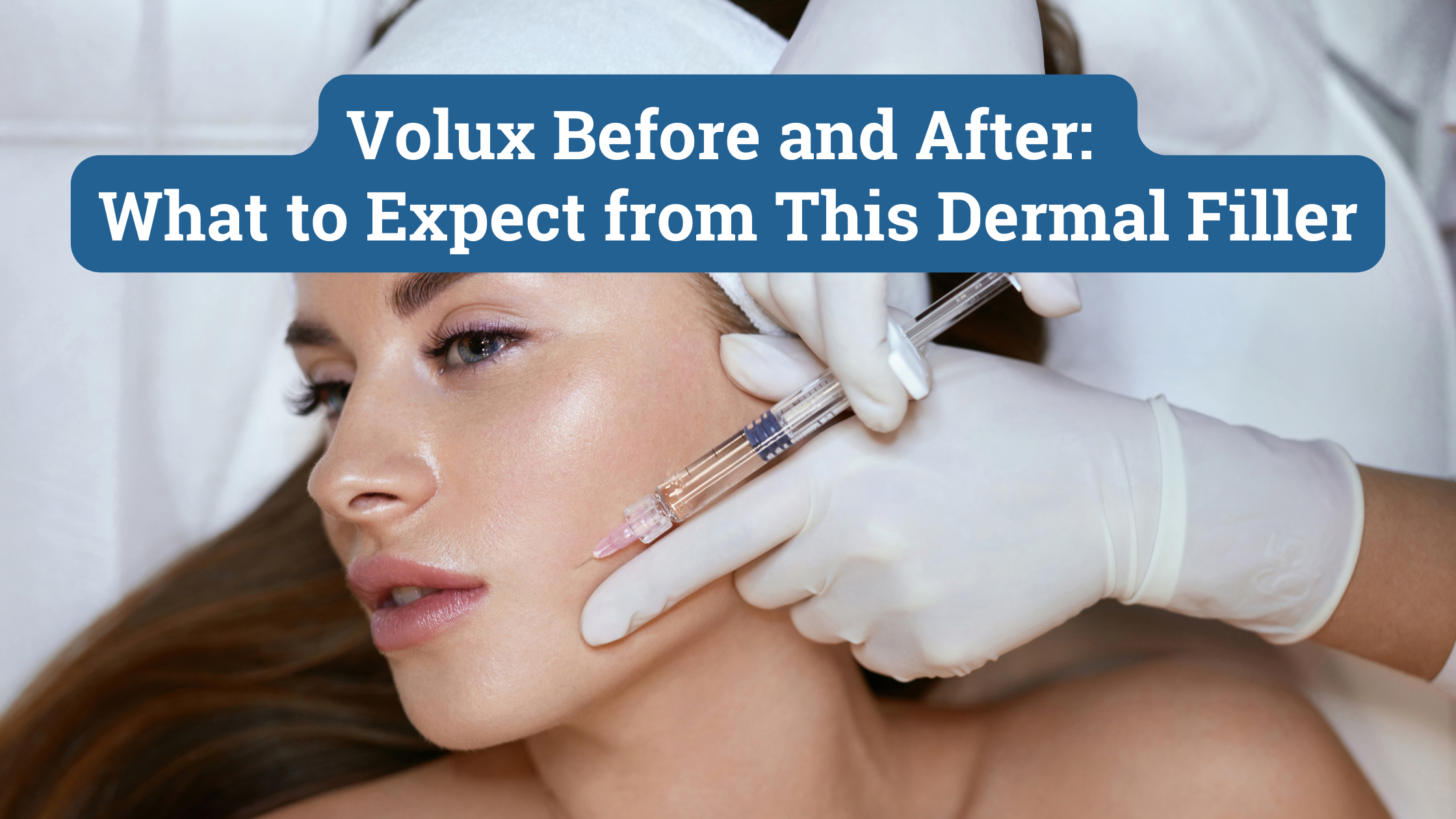 Volux Before and After: What to Expect from This Dermal Filler