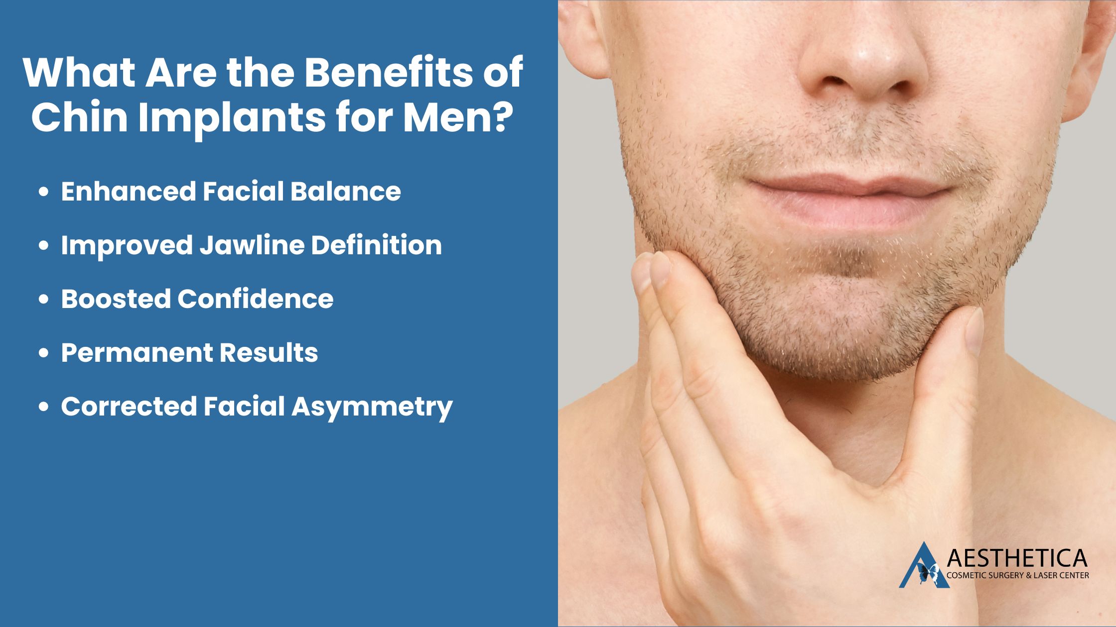 What Are the Benefits of Chin Implants for Men?