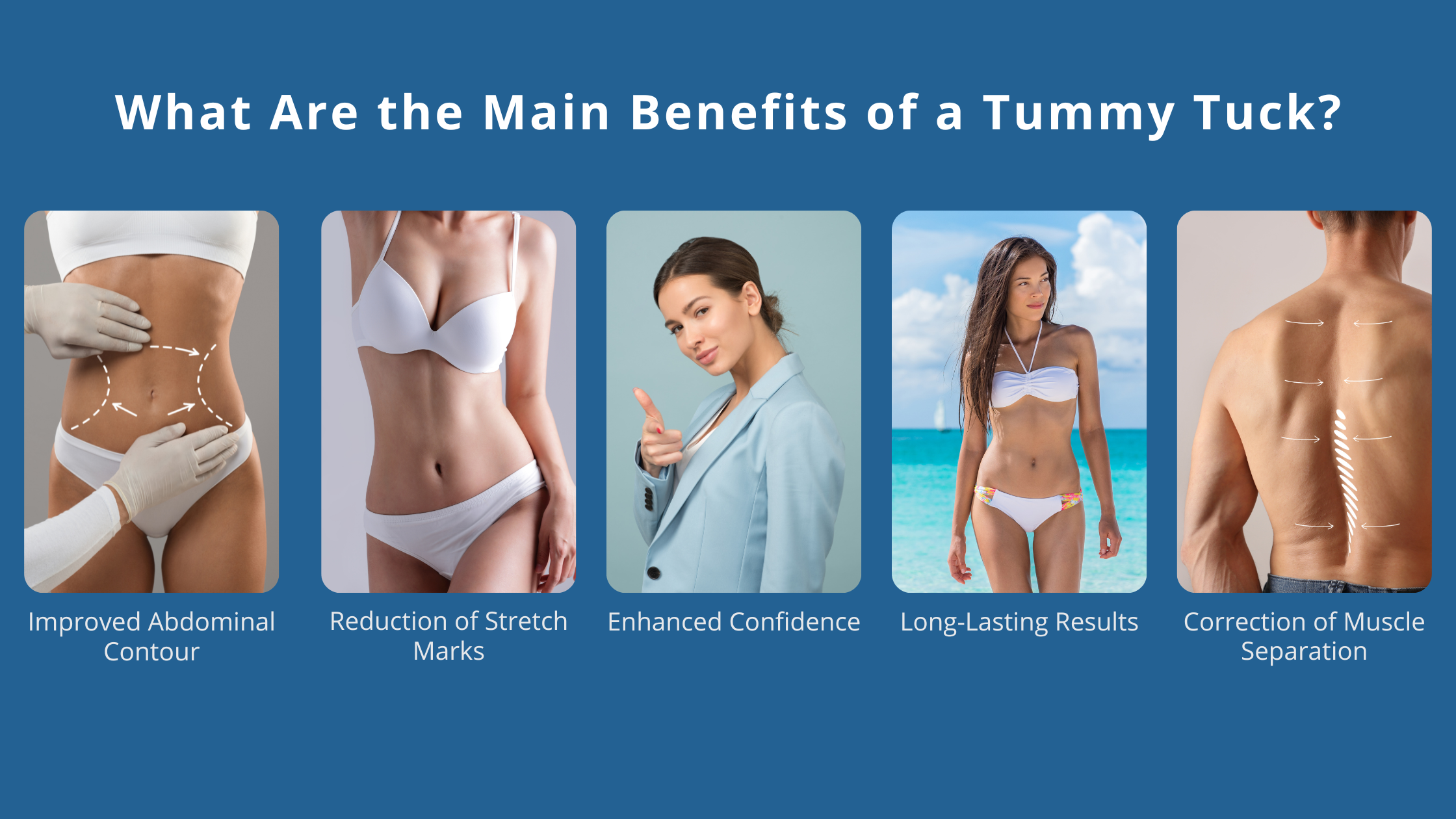 Main Benefits of a Tummy Tuck