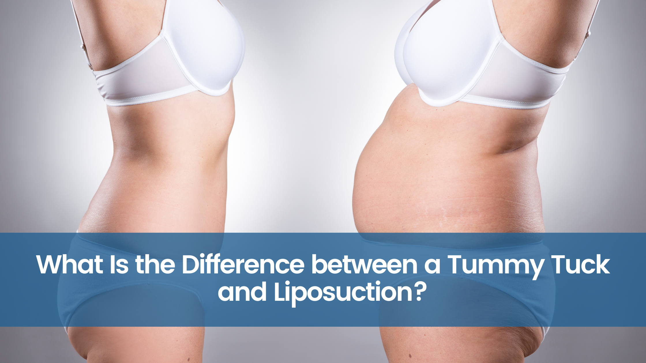 What Is the Difference between a Tummy Tuck and Liposuction?