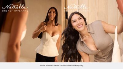 Smiling woman showcasing Natrelle breast implants