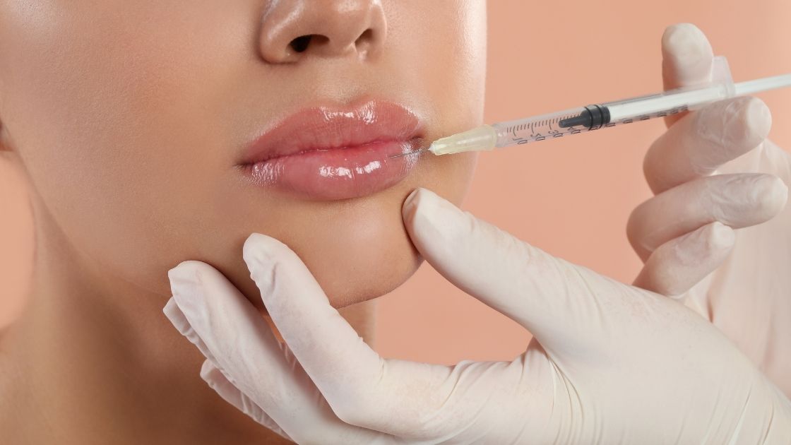 Doctor performing lip filler injection procedure