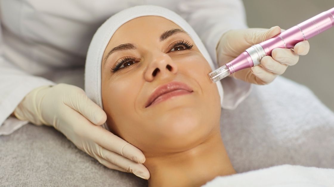 smiling young woman receiving microneedling treatment while esthetician using dermapen on her face