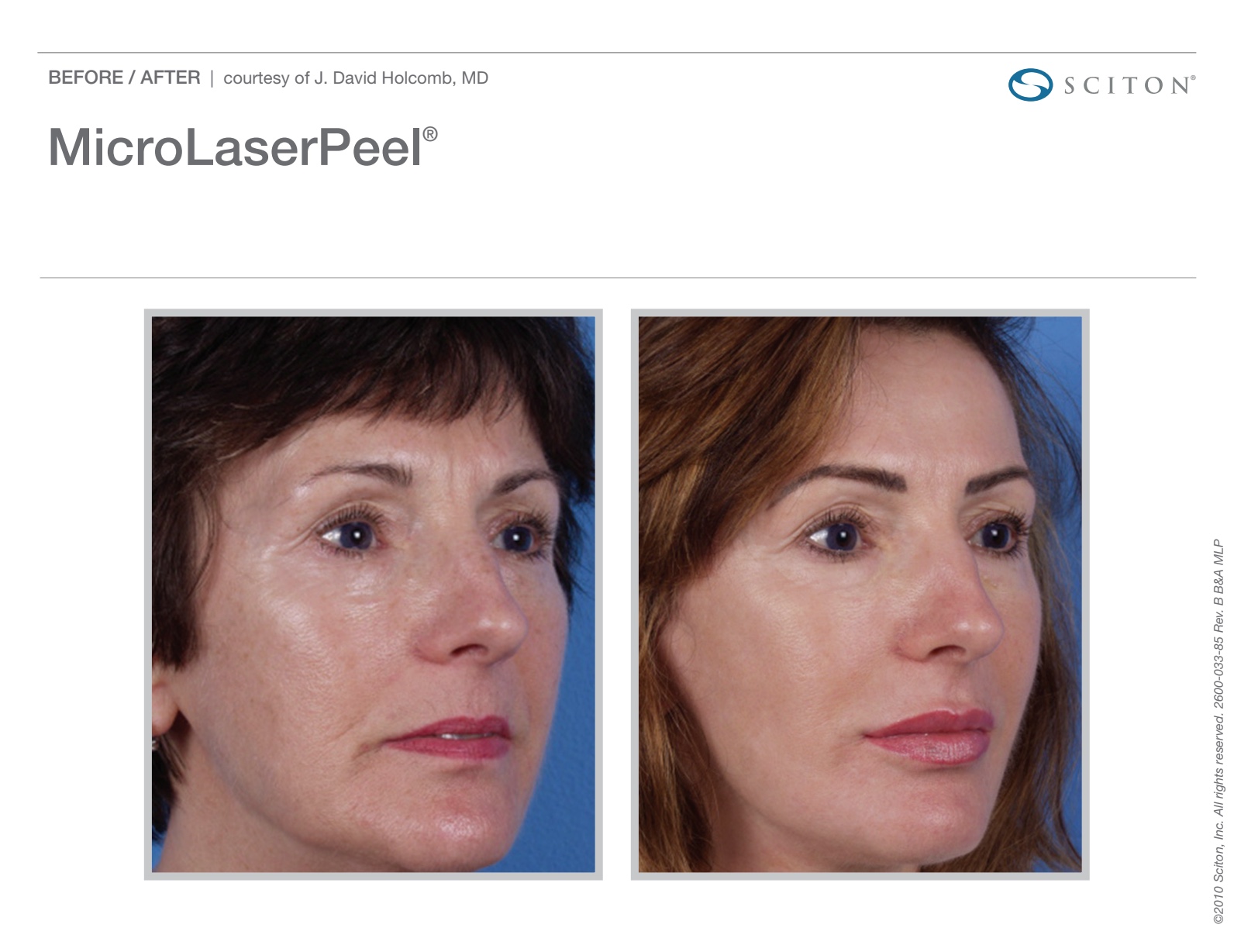 September Special: Save 25% on the Most Advanced Laser Treatments in Leesburg, VA